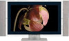 Reviews and ratings for Sony PDM-4210 - Plasma Display Panel